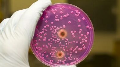 Patológiás kisülés férfiaknál izgatottan